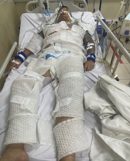 A blood donation event with people donating blood.3